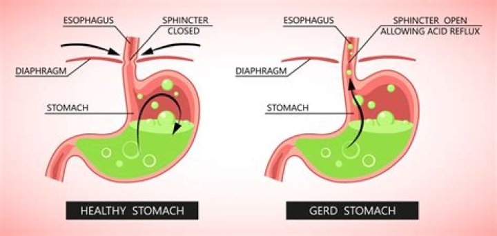 Gerd Müller Cause Of Death: How Did Gerd Müller Die?